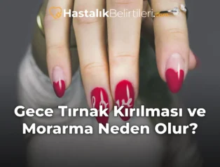 Gece Tırnak Kırılması ve Morarma Neden Olur?