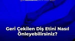 Geri Çekilen Diş Etini Nasıl Önleyebilirsiniz?
