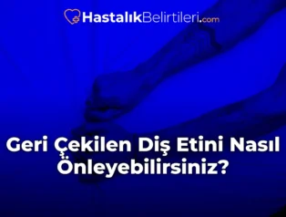 Geri Çekilen Diş Etini Nasıl Önleyebilirsiniz?