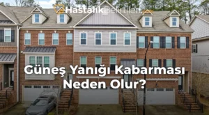 Güneş Yanığı Kabarması Neden Olur?