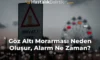 Göz Altı Morarması Neden Oluşur, Alarm Ne Zaman? Göz Altı Morarması Neden Oluşur, Alarm Ne Zaman?