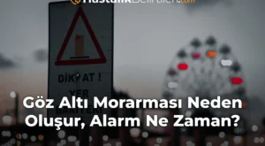 Göz Altı Morarması Neden Oluşur, Alarm Ne Zaman?