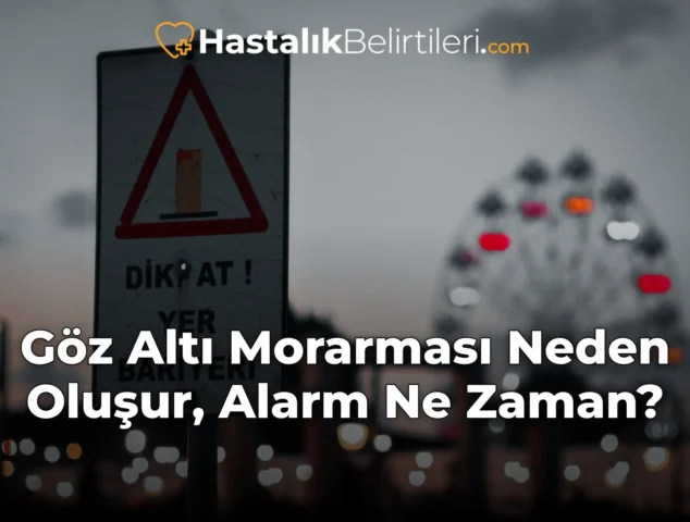Göz Altı Morarması Neden Oluşur, Alarm Ne Zaman?