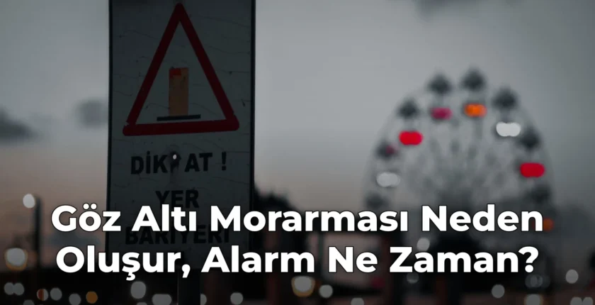 Göz Altı Morarması Neden Oluşur, Alarm Ne Zaman?