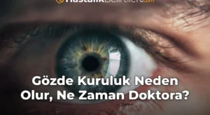 Gözde Kuruluk Neden Olur, Ne Zaman Doktora?