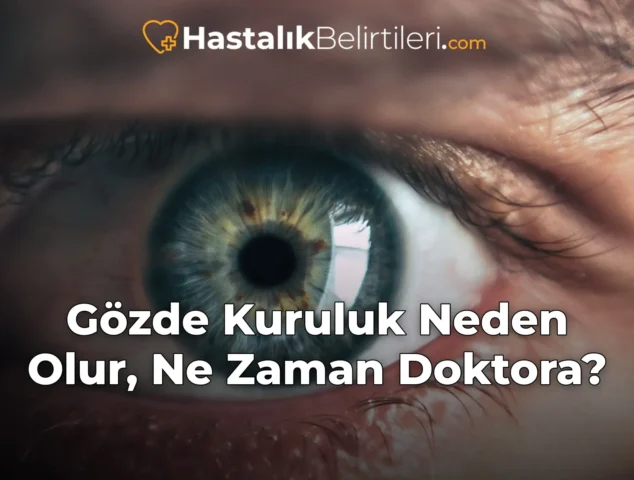 Gözde Kuruluk Neden Olur, Ne Zaman Doktora?