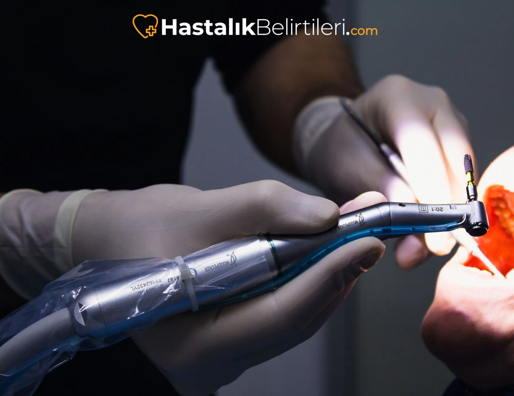 Kadınlarda İdrar Kaçırma Nedenleri Nedir? 4 Kadın fizyoterapisi: pelvik taban egzersizleriyle destek tedavi