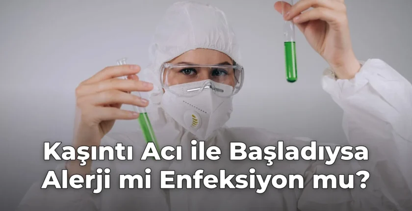 Kaşıntı Acı ile Başladıysa Alerji mi Enfeksiyon mu?