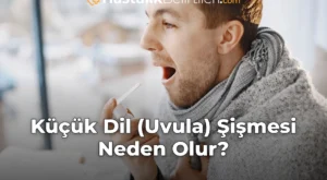 Küçük Dil (Uvula) Şişmesi Neden Olur?