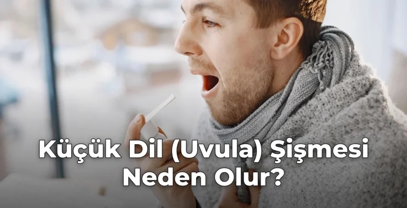 Küçük Dil (Uvula) Şişmesi Neden Olur? Küçük Dil (Uvula) Şişmesi Neden Olur?
