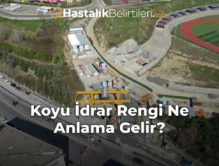 Koyu İdrar Rengi Ne Anlama Gelir?