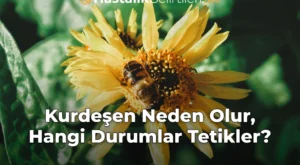 Kurdeşen Neden Olur, Hangi Durumlar Tetikler?