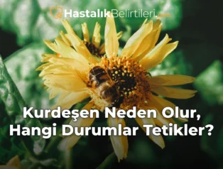 Kurdeşen Neden Olur, Hangi Durumlar Tetikler?