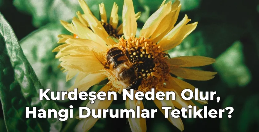 Kurdeşen Neden Olur, Hangi Durumlar Tetikler?