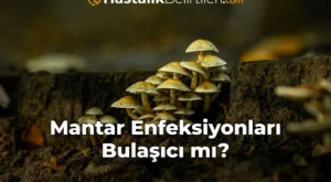 Mantar Enfeksiyonları Bulaşıcı mı?