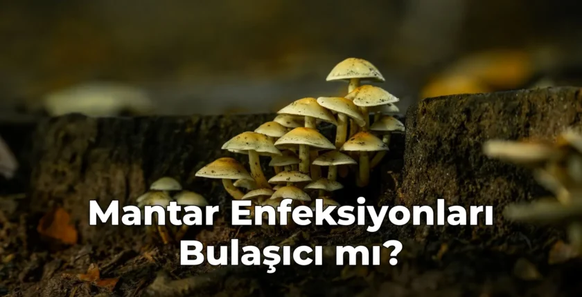 Mantar Enfeksiyonları Bulaşıcı mı?