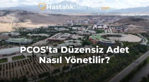 PCOS’ta Düzensiz Adet Nasıl Yönetilir?