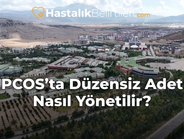 PCOS’ta Düzensiz Adet Nasıl Yönetilir?