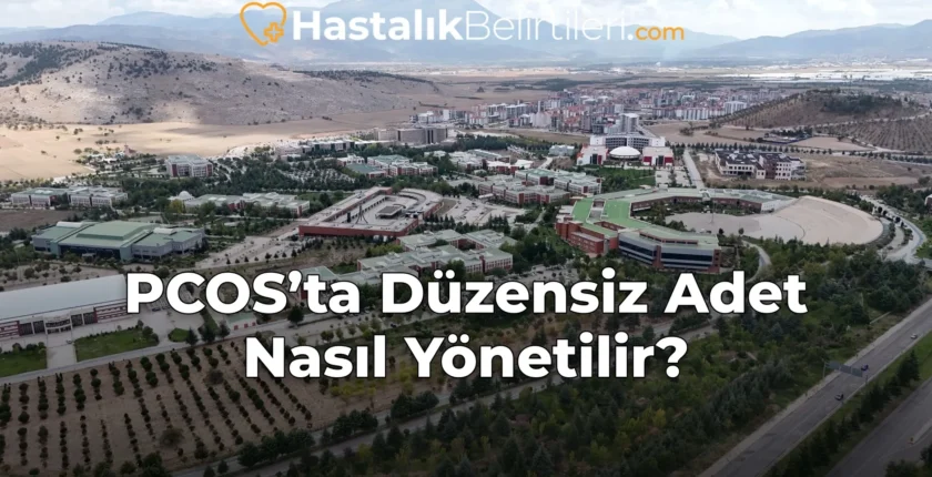 PCOS’ta Düzensiz Adet Nasıl Yönetilir?