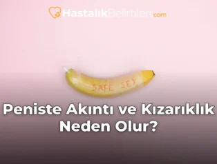 Peniste Akıntı ve Kızarıklık Neden Olur?