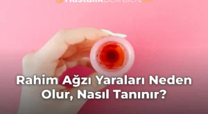 Rahim Ağzı Yaraları Neden Olur, Nasıl Tanınır?