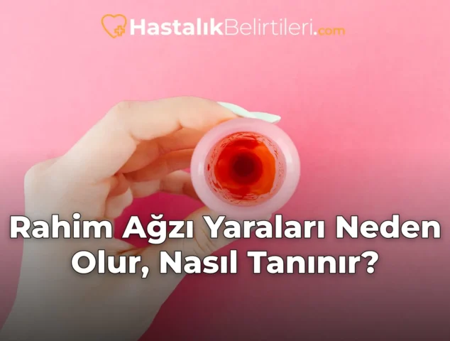 Rahim Ağzı Yaraları Neden Olur, Nasıl Tanınır?