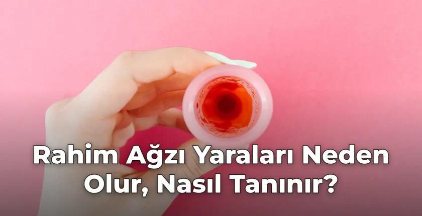 Rahim Ağzı Yaraları Neden Olur, Nasıl Tanınır?