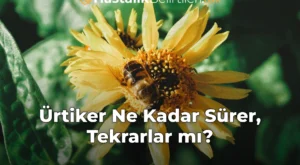 Ürtiker Ne Kadar Sürer, Tekrarlar mı?