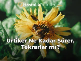 Ürtiker Ne Kadar Sürer, Tekrarlar mı?