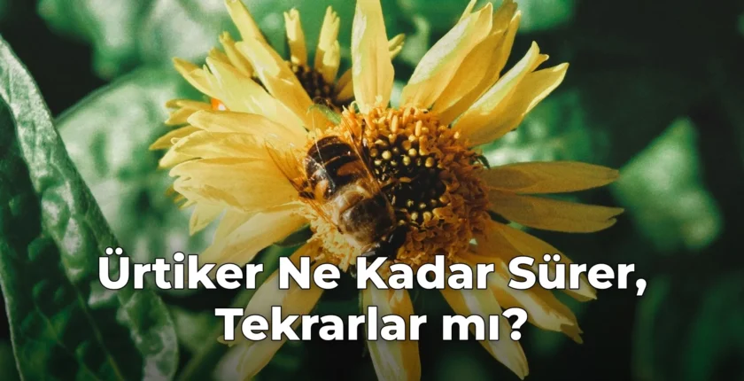 Ürtiker Ne Kadar Sürer, Tekrarlar mı?