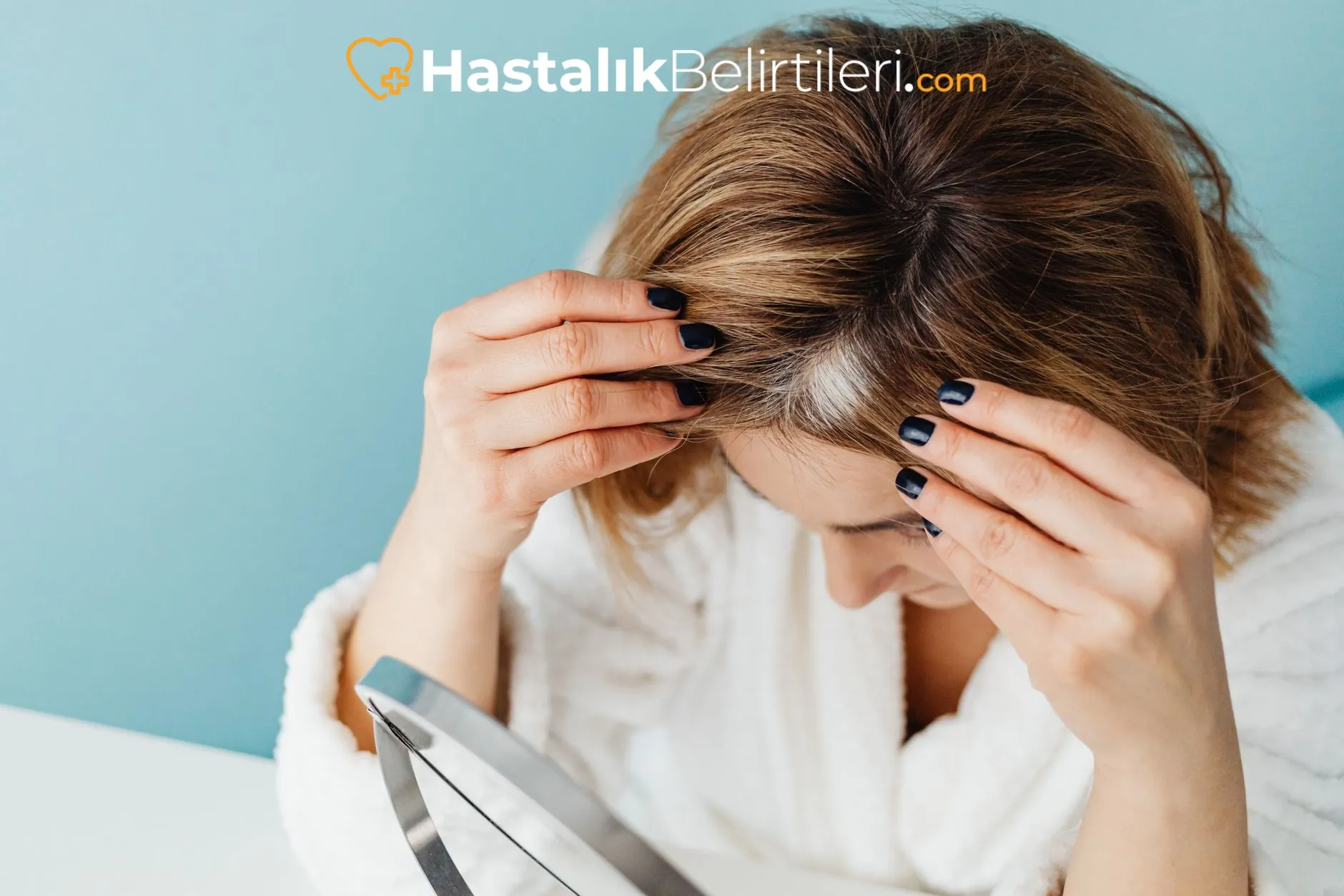 Saç Dökülmesi için Hormon Kontrolü Ne Zaman? 4 Erkeklik hormonları saç dökülmesi örüntüsünü gösteren şematik görsel