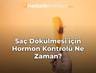 Saç Dökülmesi için Hormon Kontrolü Ne Zaman?