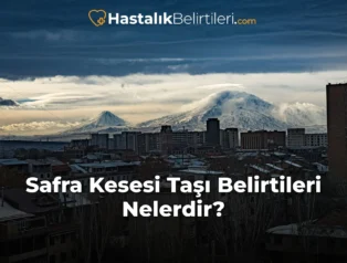 Safra Kesesi Taşı Belirtileri Nelerdir?