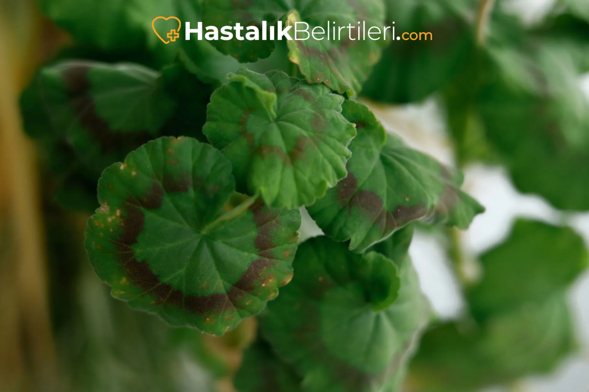 Alevlenmeyi tetikleyen stres etkisiyle sedef alevlenmesi
