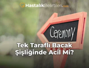 Tek Taraflı Bacak Şişliğinde Acil Mi?