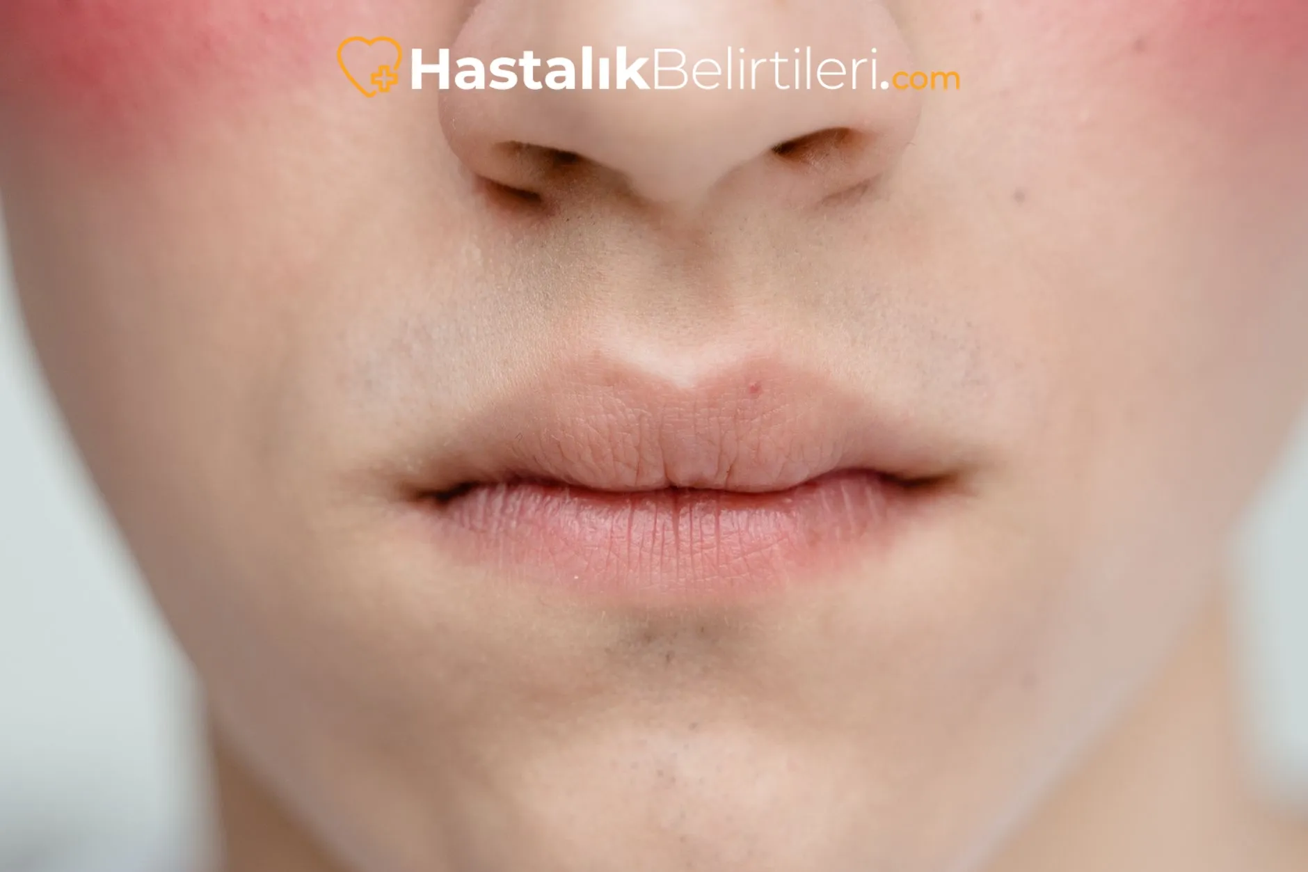 Testis burulması belirtisi, ani şiddetli ağrı diyagramı