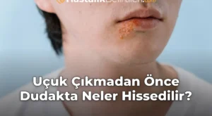 Uçuk Çıkmadan Önce Dudakta Neler Hissedilir?