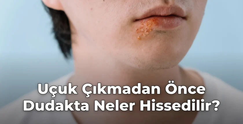 Uçuk Çıkmadan Önce Dudakta Neler Hissedilir?