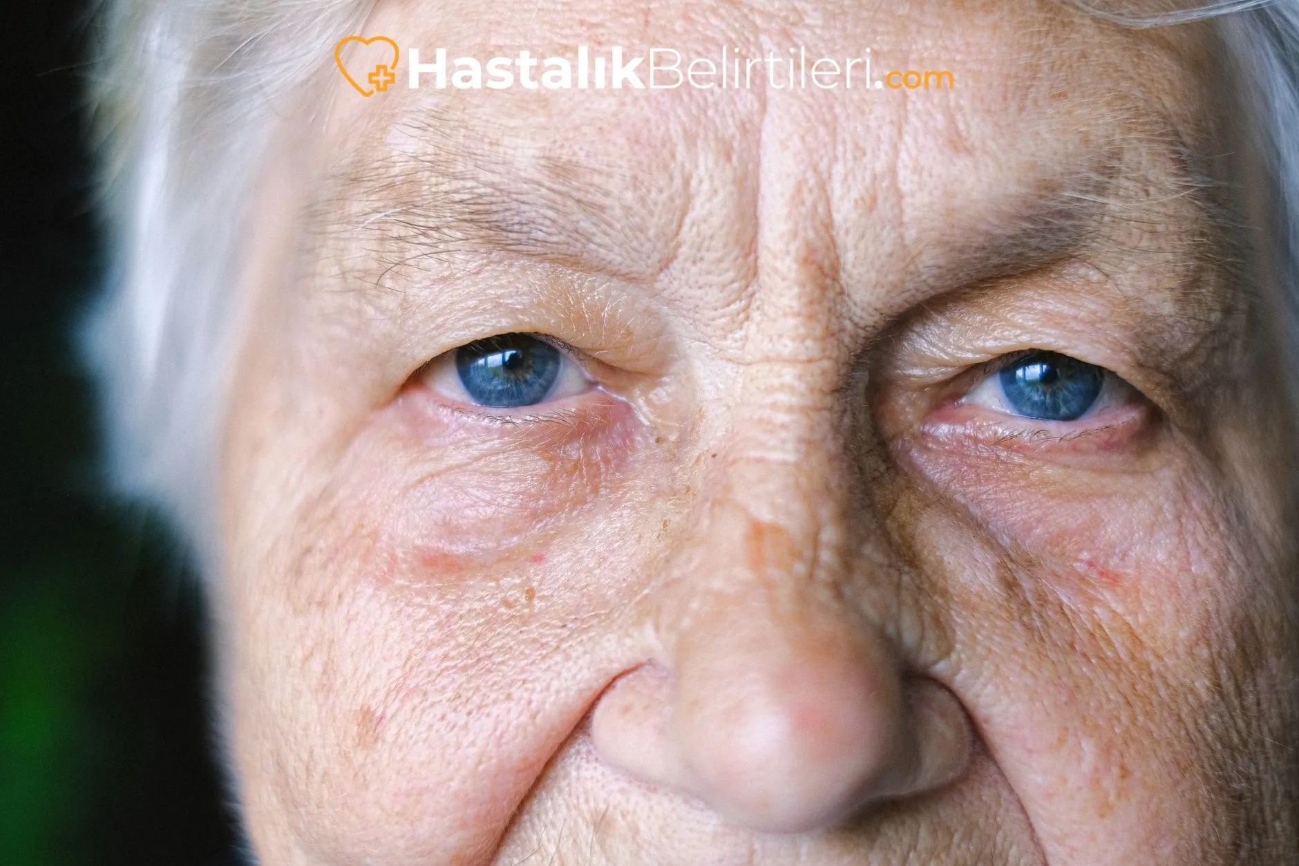 Yaşa Bağlı Makula Değişikliği Belirtileri Nelerdir? 3 Merkez görme bulanıklığı yaşayan yaşlı kişi