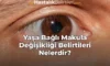 Yaşa Bağlı Makula Değişikliği Belirtileri Nelerdir?
