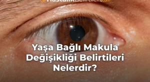 Yaşa Bağlı Makula Değişikliği Belirtileri Nelerdir?