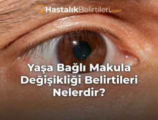 Yaşa Bağlı Makula Değişikliği Belirtileri Nelerdir?