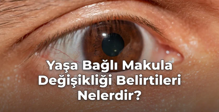 Yaşa Bağlı Makula Değişikliği Belirtileri Nelerdir?